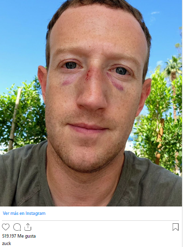 Moretones en la cara de Mark Zuckerberg: «la pelea se salió un poco de control»